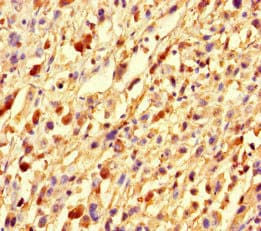 Polyclonal Rabbit anti-Human GMIP Antibody (IHC, IF)