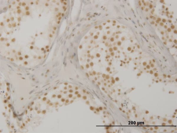 OXSR1 / OSR1 Antibody (clone 1D10)