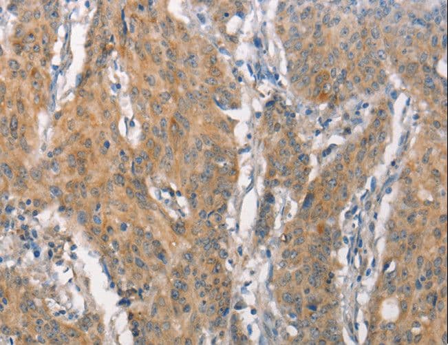 CD66c / CEACAM6 Antibody