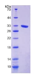 Human EXO1 Protein (Recombinant His-T7)