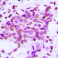 HK1 / Hexokinase 1 Antibody (N-Terminus)