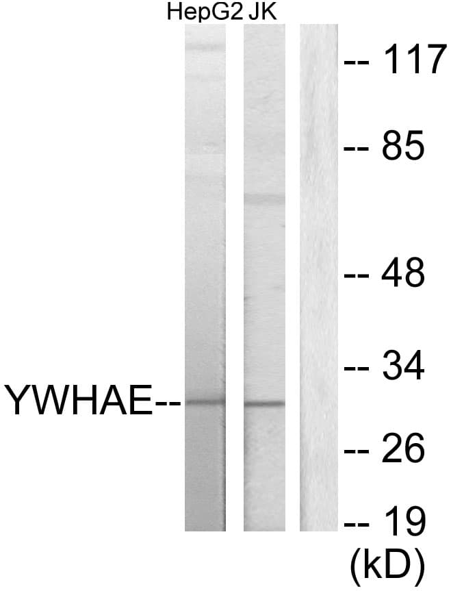 Polyclonal Rabbit anti-Human YWHAE / 14-3-3 Epsilon Antibody (aa206-255, WB)