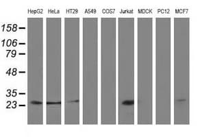 CLPP Antibody (clone OTI1G9)