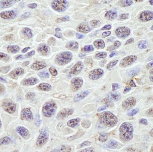 GNL3 / NS / Nucleostemin Antibody (aa500-C-term)