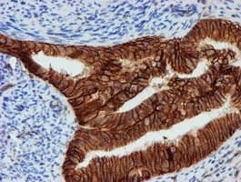 Monoclonal Mouse anti-Human FXYD3 Antibody (clone OTI1E8, IHC, IF, WB)
