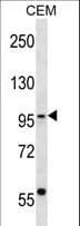 IHC-plus™ Polyclonal Rabbit anti-Human SEC63 Antibody (aa139-168, IHC, WB)