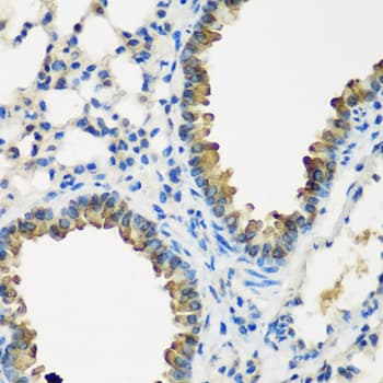 Polyclonal Rabbit anti-Human CYP2F / CYP2F1 Antibody (IHC, WB)
