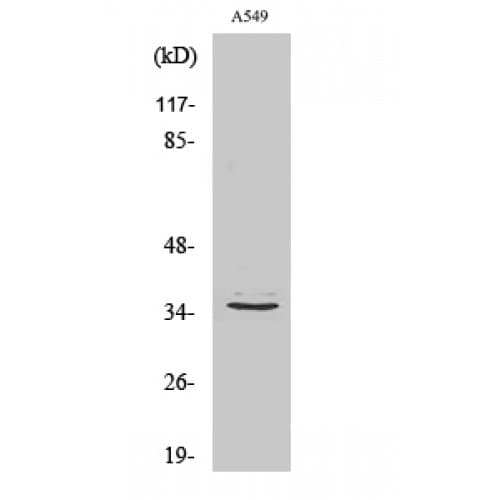 Polyclonal Rabbit anti-Human GPR82 Antibody (90-170 aa, Internal, WB)