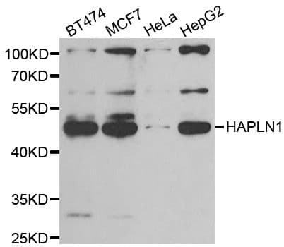 Polyclonal Rabbit anti-Human HAPLN1 Antibody (IHC, WB)