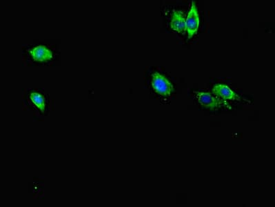 Polyclonal Rabbit anti-Human RAB12 Antibody (IF, WB)