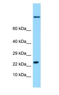 HSPB9 Antibody (aa51-100)