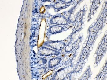 Polyclonal Rabbit anti-Human ANGPTL2 / ARP2 Antibody (IHC, WB)