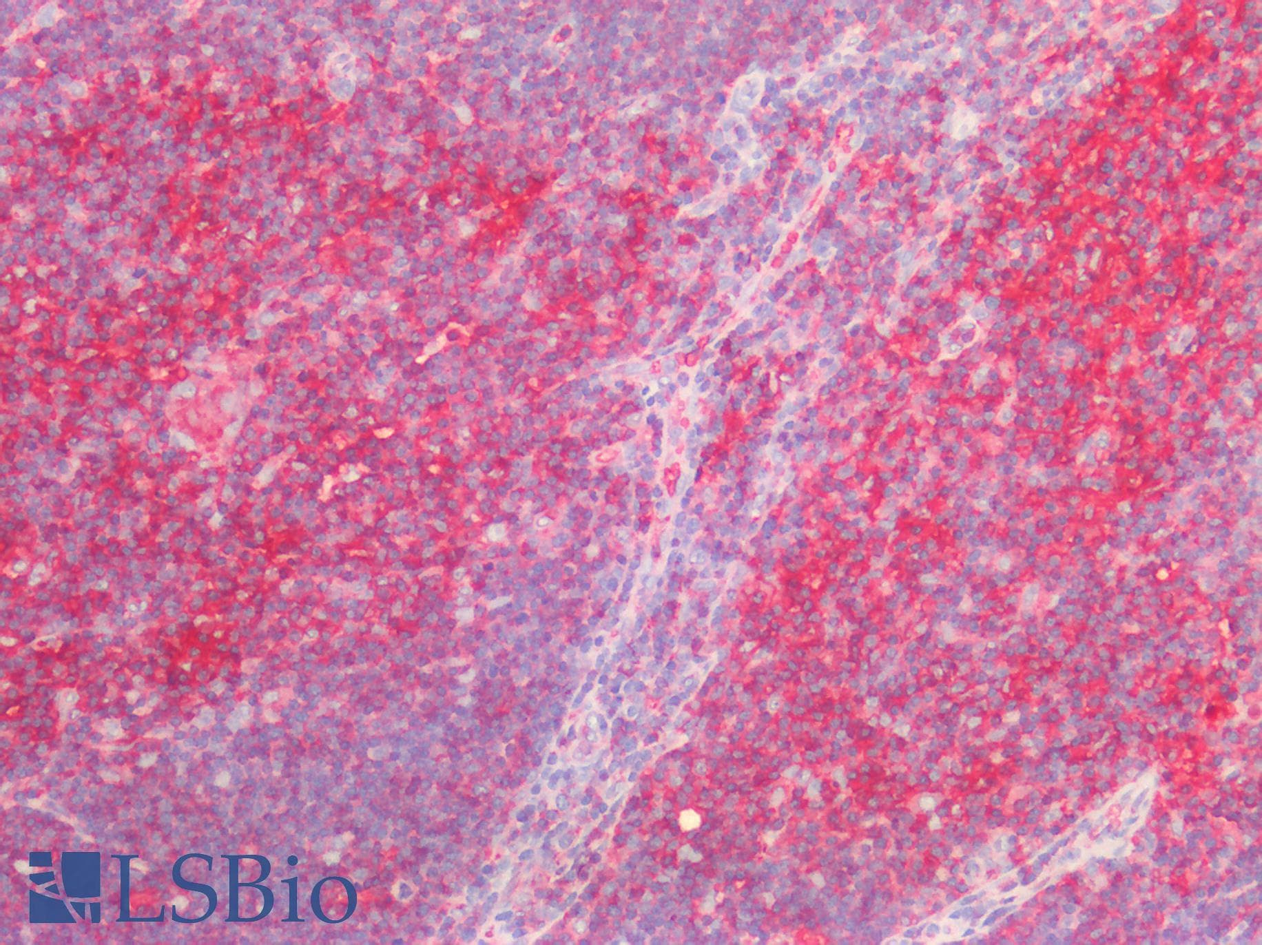 PathPlus™ B2M / Beta 2 Microglobulin Antibody (clone OTI1A9)