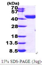 Human ECI2 / PECI Protein (Recombinant His)