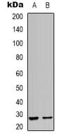 HSPB2 / HSP27 Antibody (C-Terminus)