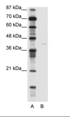 KCNA7 / Kv1.7 Antibody (C-Terminus)