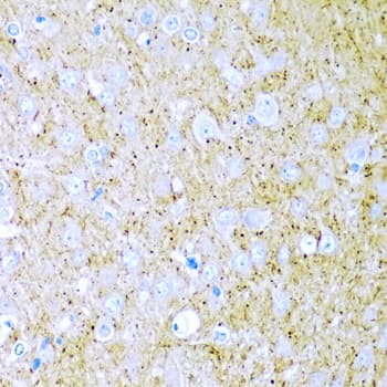 WNT2 / IRP Antibody
