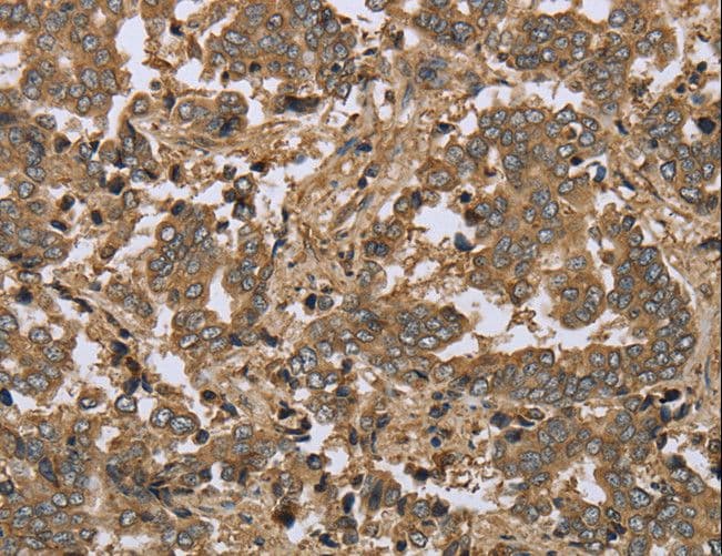 Polyclonal Rabbit anti-Human IKBIP Antibody (IHC)