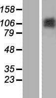 MATN2 / Matrilin 2 Protein (Over-Expression Lysate Myc-DDK (Flag))