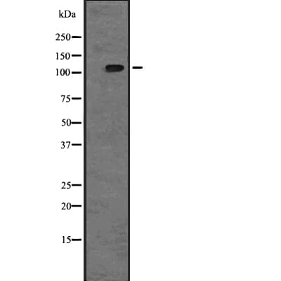 Polyclonal Rabbit anti-Human TAOK2 / TAO2 Antibody (WB)