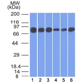 JUP/CTNNG/Junction Plakoglobin Antibody (clone 15F11)