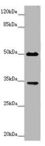 CD32B Antibody