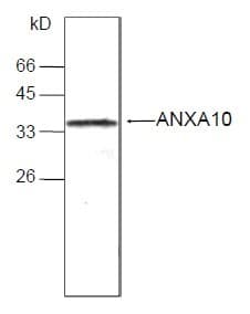 ANXA10 / Annexin A10 Antibody (aa168-324)