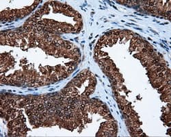 Monoclonal Mouse anti-Human ACLY / ATP Citrate Lyase Antibody (clone 3G8, Carrier-free, IHC, IF, WB)