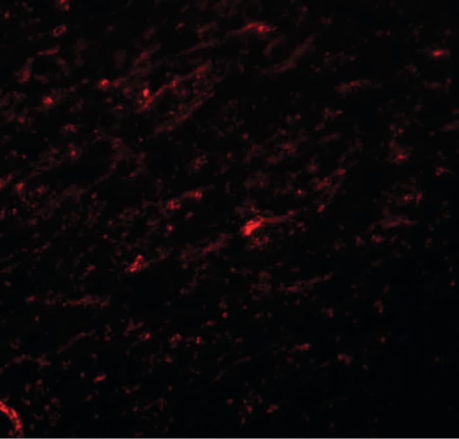 Polyclonal Rabbit anti-Human TCF3 / E2A Antibody (IHC, IF, WB)