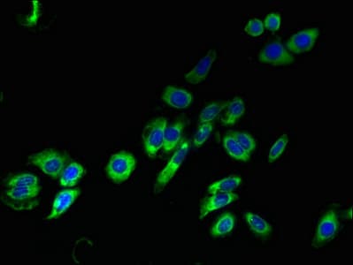 TM4SF1 Antibody