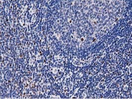MSI1 / Musashi 1 Antibody (clone OTI3G4)