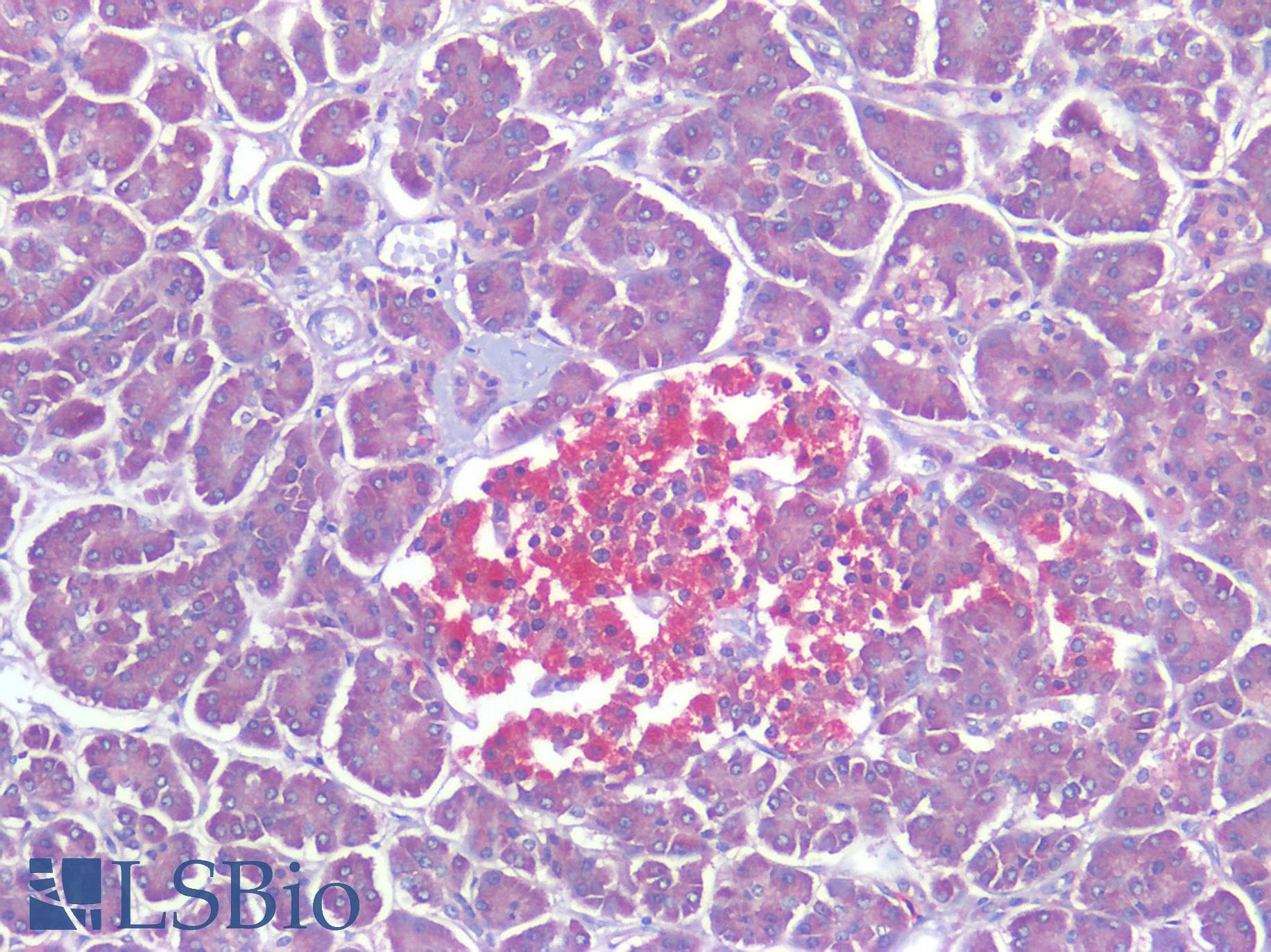 PathPlus™ CALCRL / CGRP Receptor Antibody (Cytoplasmic Domain)