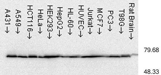 Heat Shock Protein 70 / HSPA1A Antibody (aa436-503, clone C92F3A-5)