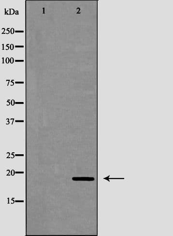 LL37 / Cathelicidin Antibody