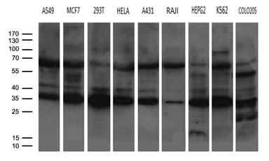 Monoclonal Mouse anti-Human PSMA7 Antibody (clone OTI8B11, Carrier-free, WB)
