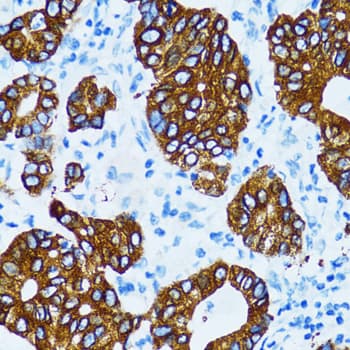 Polyclonal Rabbit anti-Human CTSE / Cathepsin E Antibody (IHC, IF, WB)
