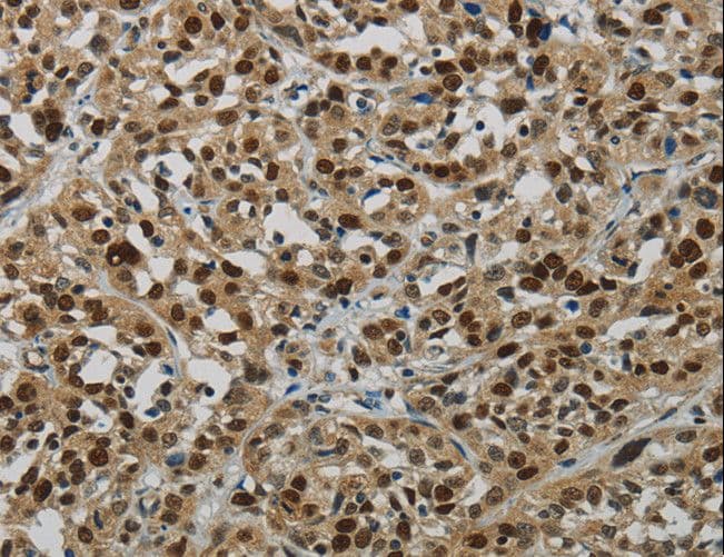 LIG1 / DNA Ligase 1 Antibody