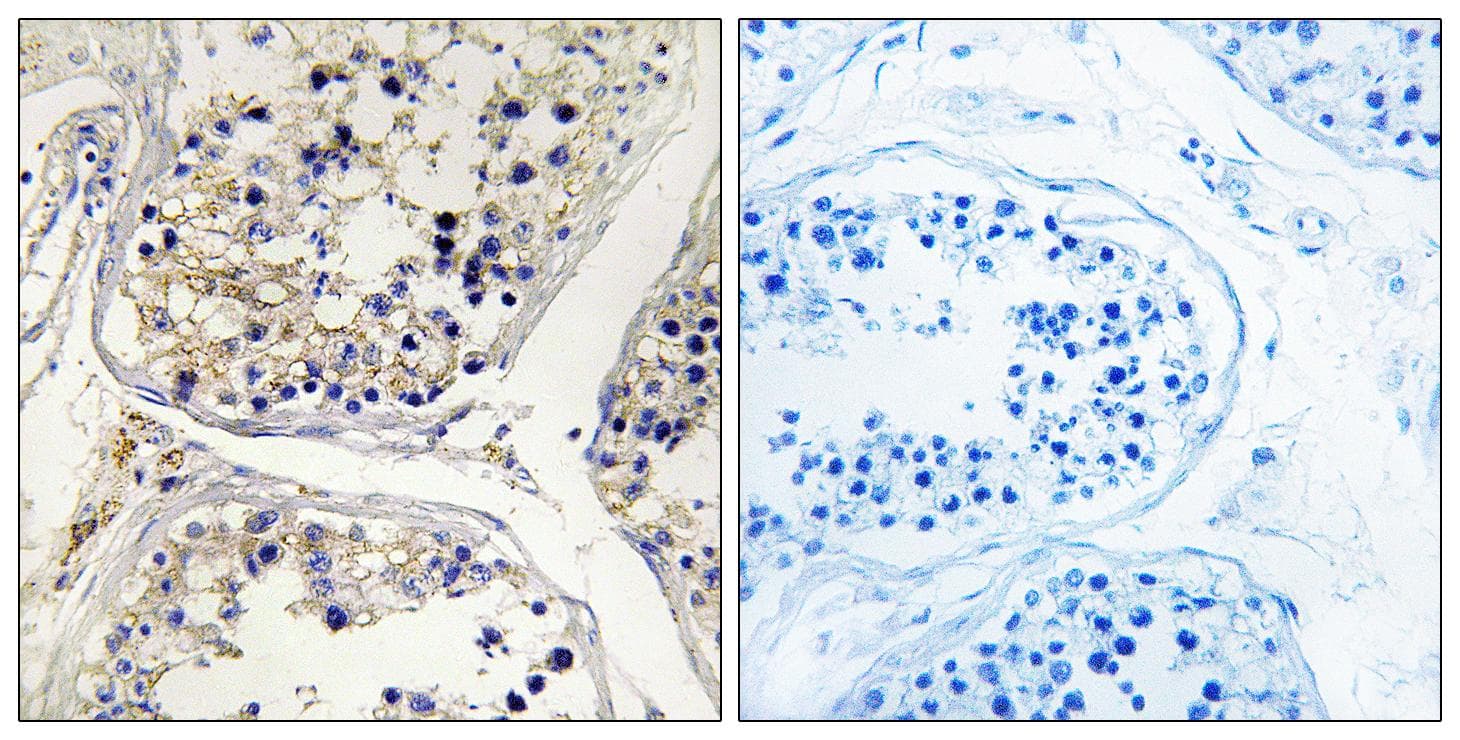 CPT1B Antibody