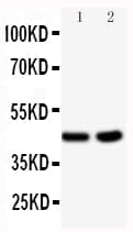 BCAT1 / ECA39 Antibody (aa360-375)
