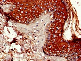 P4HA1 Antibody