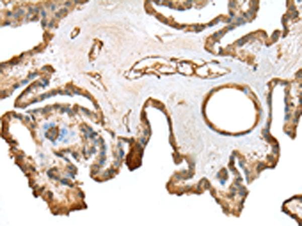 SFN / Stratifin / 14-3-3 Sigma Antibody