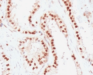 RAD51 / RECA Antibody (clone RALPA-1)