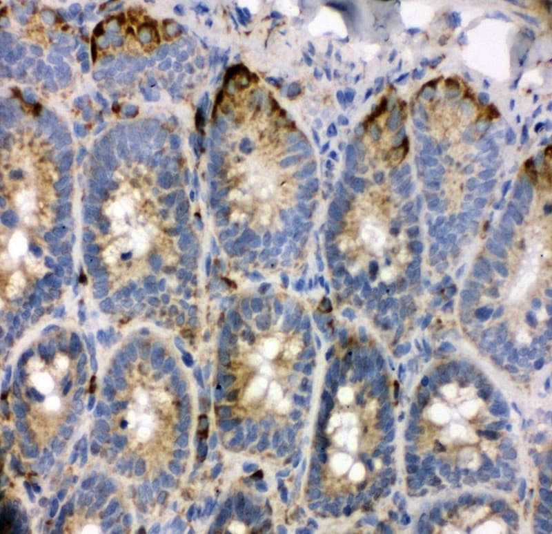 Polyclonal Rabbit anti-Human TRAM1 Antibody (aa314-331, IHC, WB)