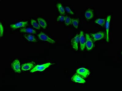 Polyclonal Rabbit anti-Human HELO1 / ELOVL5 Antibody