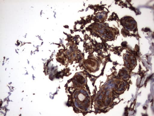 KRT7 / CK7 / Cytokeratin 7 Antibody (clone OTI2A2)