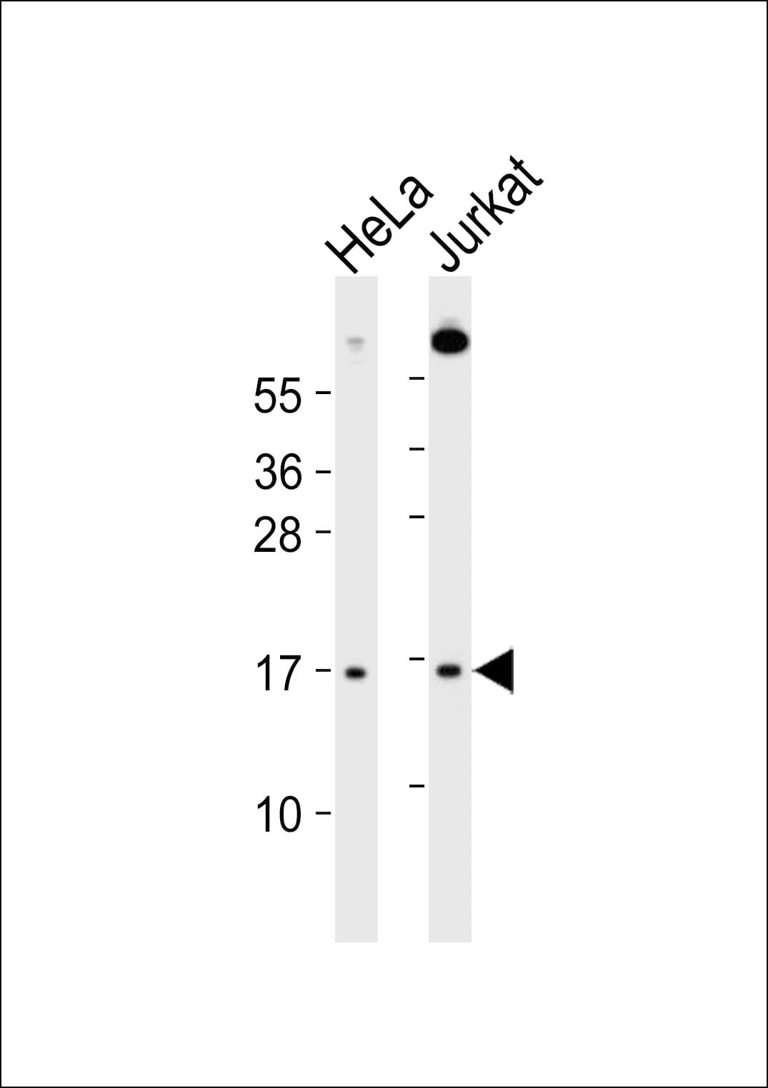 UBE2A Antibody