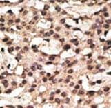 Polyclonal Rabbit anti-Human ATG9A Antibody (aa252-281, IHC, WB)