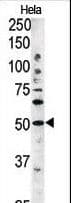 Polyclonal Rabbit anti-Human AUTL1 / ATG4C Antibody (aa167-196, IHC, WB)
