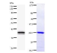 TEAD2 Antibody (clone 404C5a)