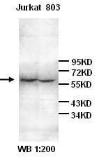 IHC-plus™ IL6R / IL6 Receptor Antibody